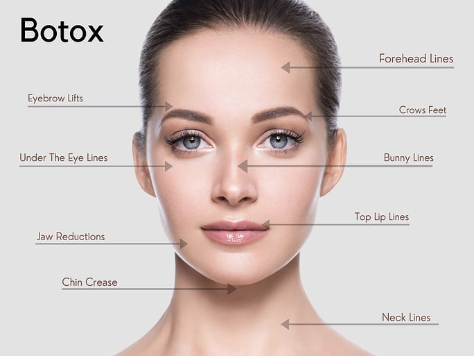botox