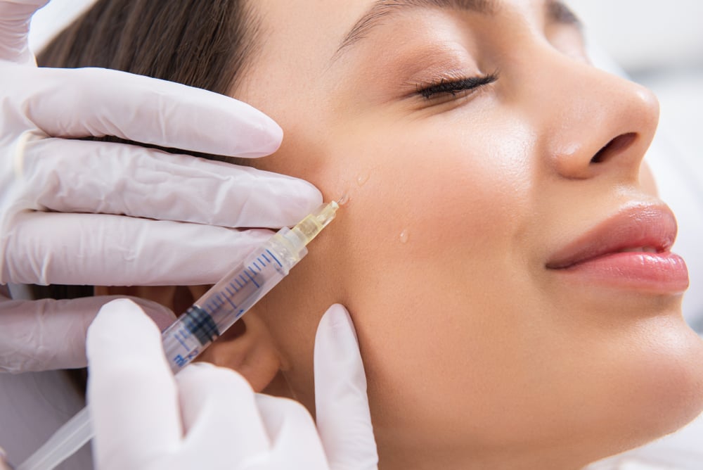 Natural looking Restylane results Chattanooga facial rejuvenation