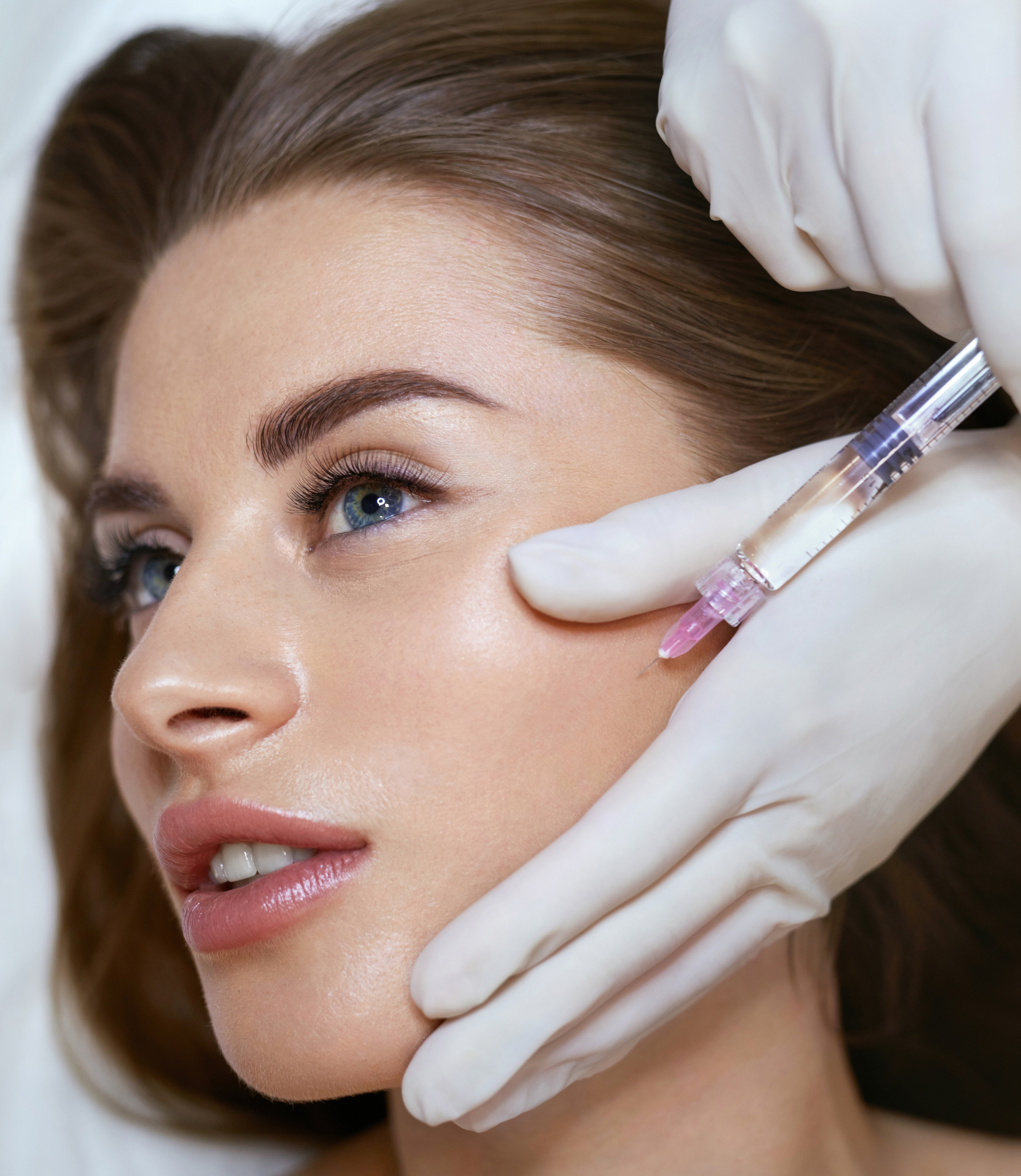 Patient receiving Restylane injections Chattanooga expert injector