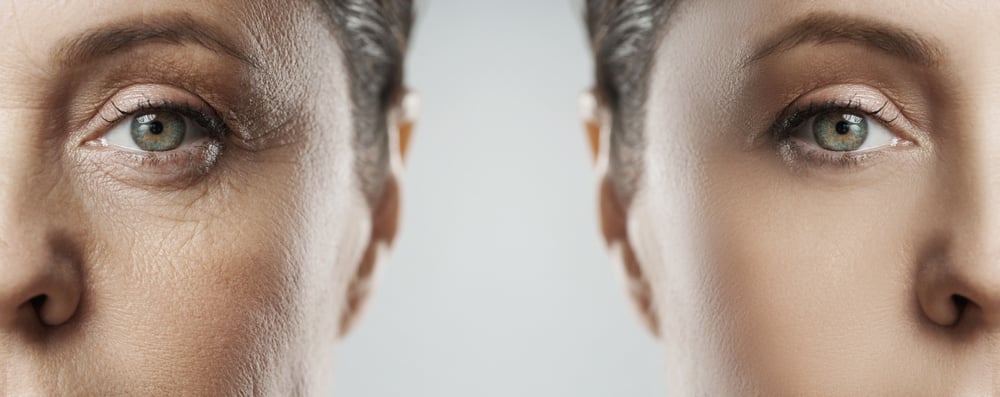 Advanced microneedling facial Chattanooga TN