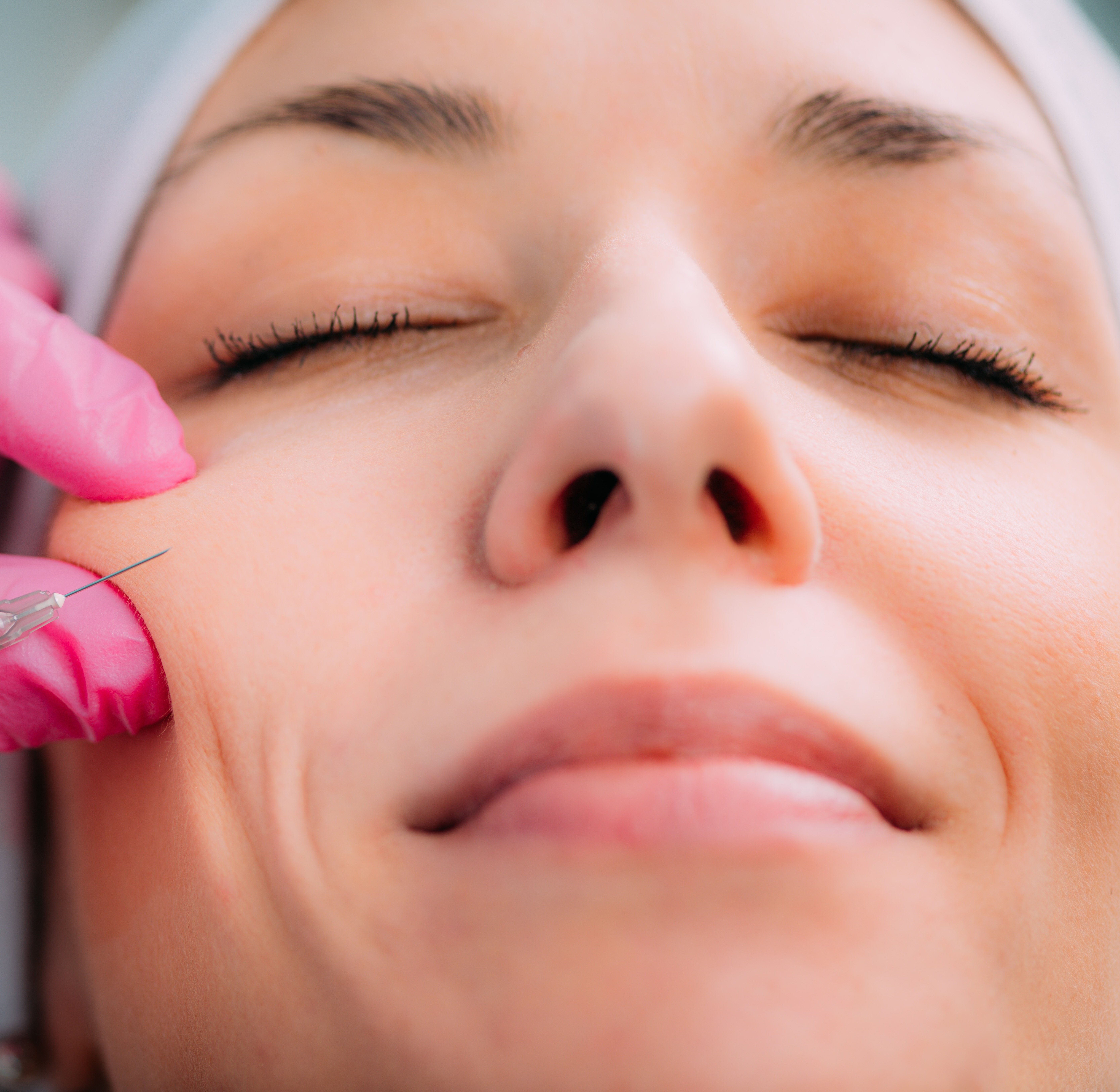 Cheek filler treatment Chattanooga Juvederm midface volume restoration
