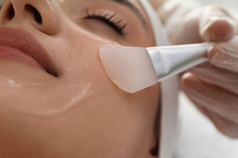 Medical grade chemical peel for uneven skin tone in Chattanooga