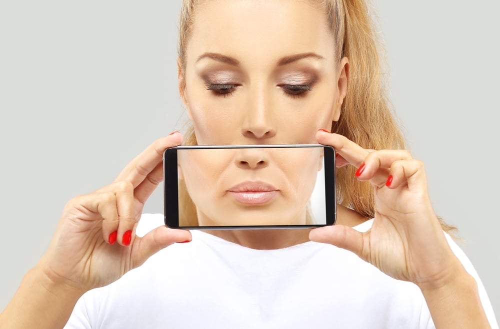 RHA lip filler Chattanooga natural lip enhancement soft flexible results