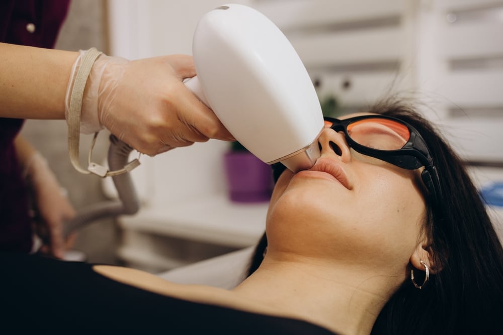 Laser hair removal service for smoother skin at CFR Aesthetics in Chattanooga TN