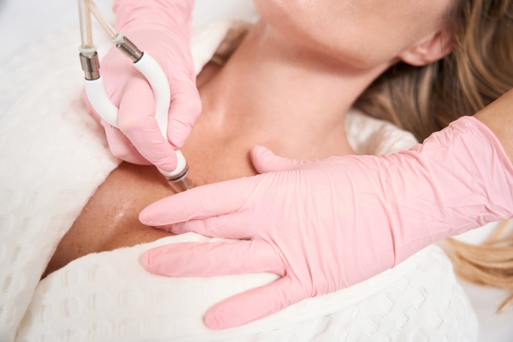 Fractional CO2 laser treatment for smoother skin texture in Chattanooga TN