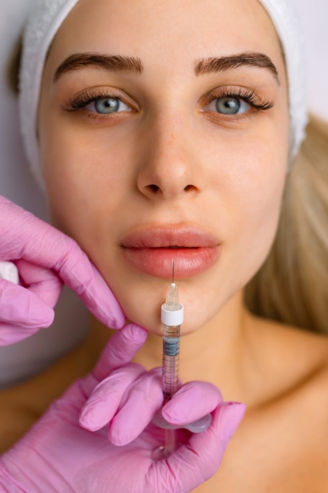 Patient receiving Sculptra facial rejuvenation treatment
