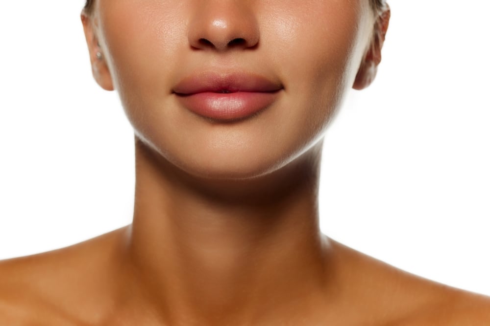 Before and after Kybella Chattanooga TN reducing chin fat