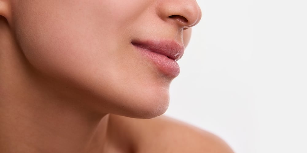 RHA filler Chattanooga TN smile lines treatment natural dynamic results