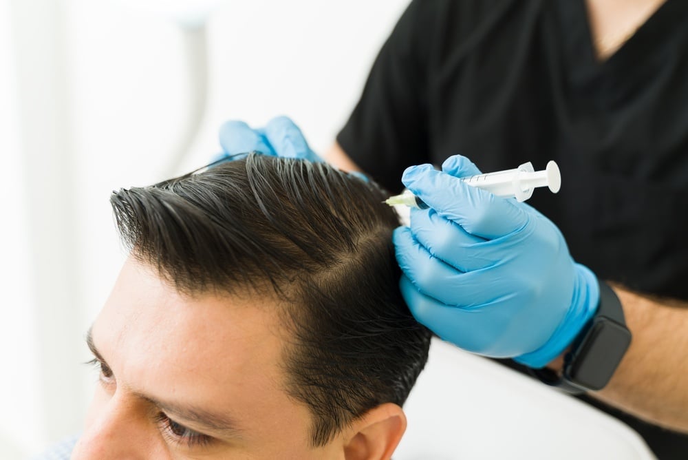 Scalp microneedling for hair restoration support at CFR Aesthetics Chattanooga