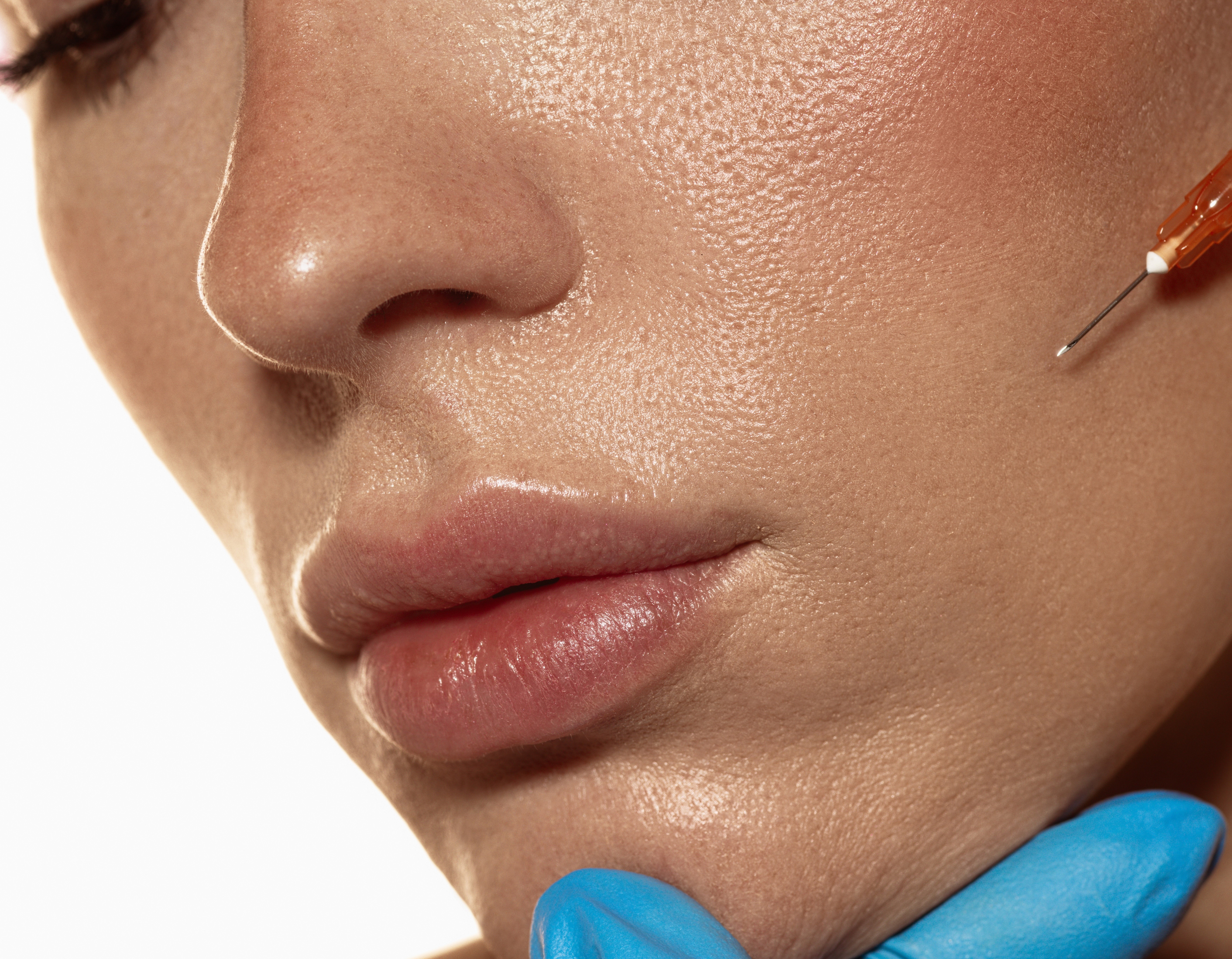 Juvederm treatment in Chattanooga TN for natural facial volume restoration