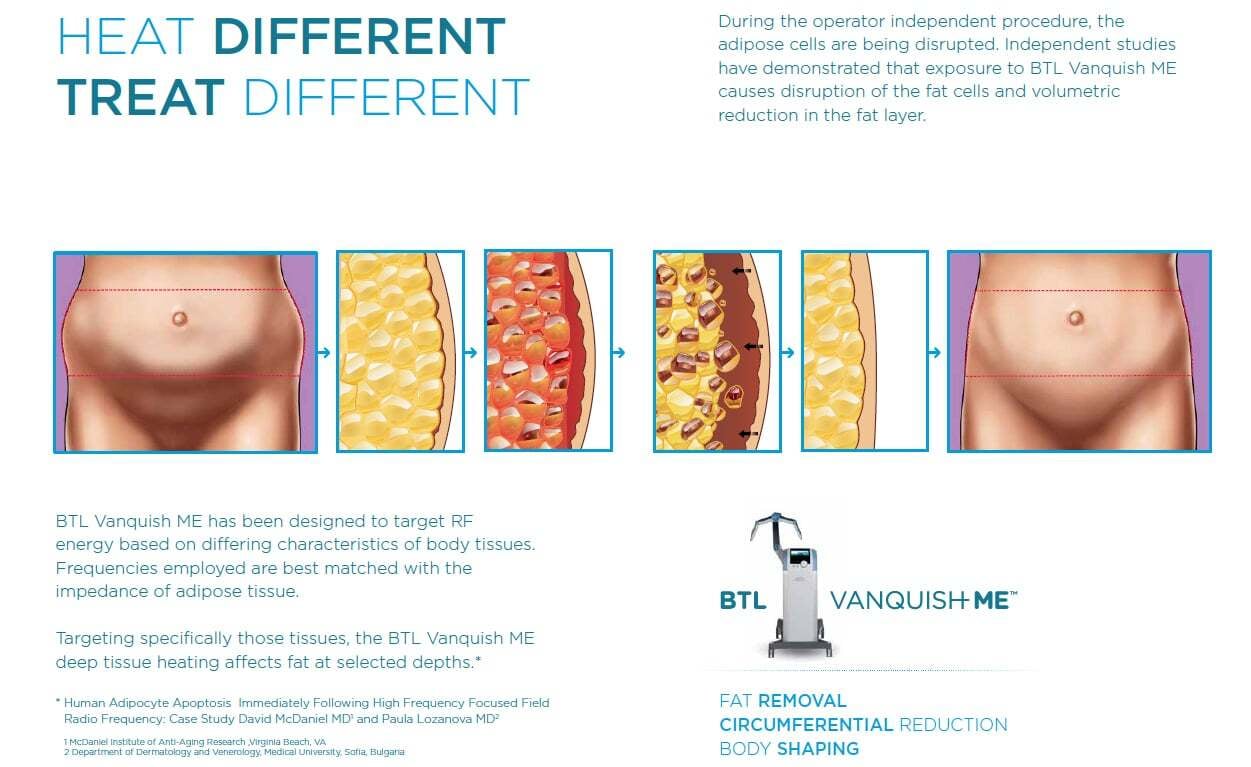 vanquish-science
